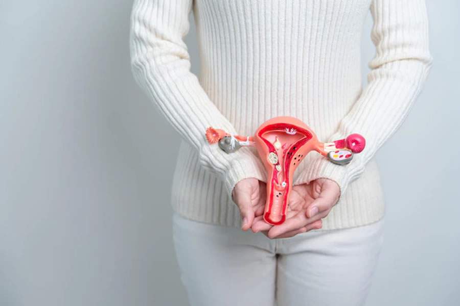 Miomas uterinos: Especialista tira as principais dúvidas sobre a doença
