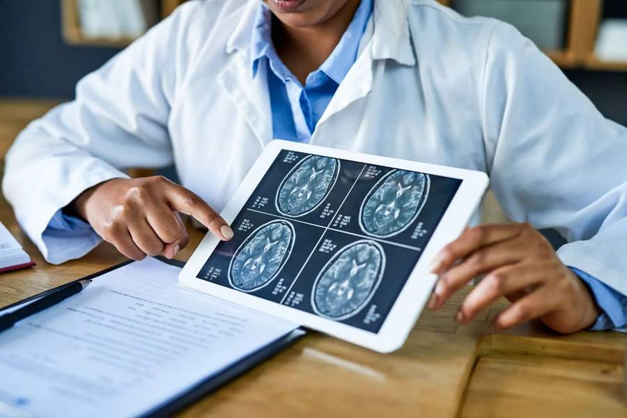 Tumor cerebral: são mais de 11 mil novos casos por ano, por isso, fique atento aos sintomas