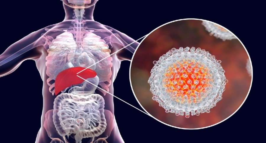 Julho Amarelo: novo teste da Roche Diagnóstica ajuda a reduzir em quatro semanas diagnóstico de hepatite C